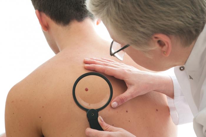 احذر من هذه الأمراض الجلدية التي تهدد حياتك مجموعة من الأمراض الجلدية الخطيرة التي من الممكن أن تهدد حياة صاحبها أمراض الجلد بثور