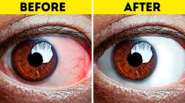 8 تمارين لأصحاب العيون المتعبة مجموعة من التمارين البسيطة التي يمكنك القيام بها لتحسين نظرك الحفاظ على صحة العينين تدهور البصر